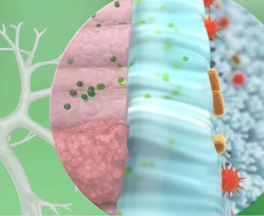 Der Wirkstoff von GeloMyrtol® forte bekämpft auf mehrfache Weise den Atemwegsinfekt und fördert den Heilungsprozess