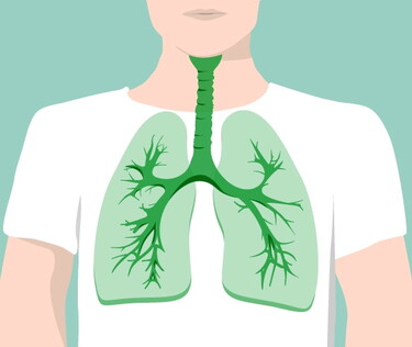 Bronchitis ist eine Entzündung der Schleimhaut in den Bronchien.